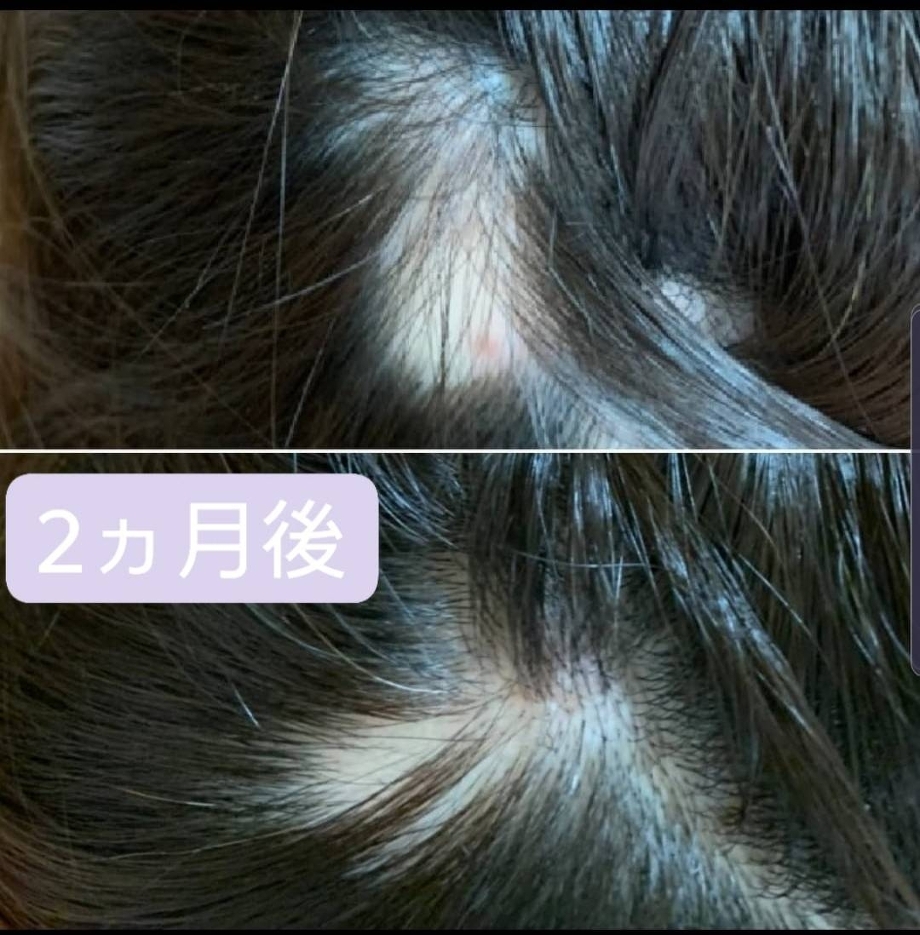 頭皮マッサージ