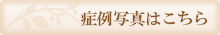 症例写真はこちら