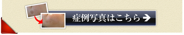 症例写真はこちら